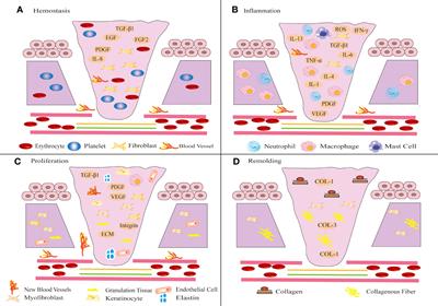Multimodal roles of transient receptor potential channel activation in inducing pathological tissue scarification